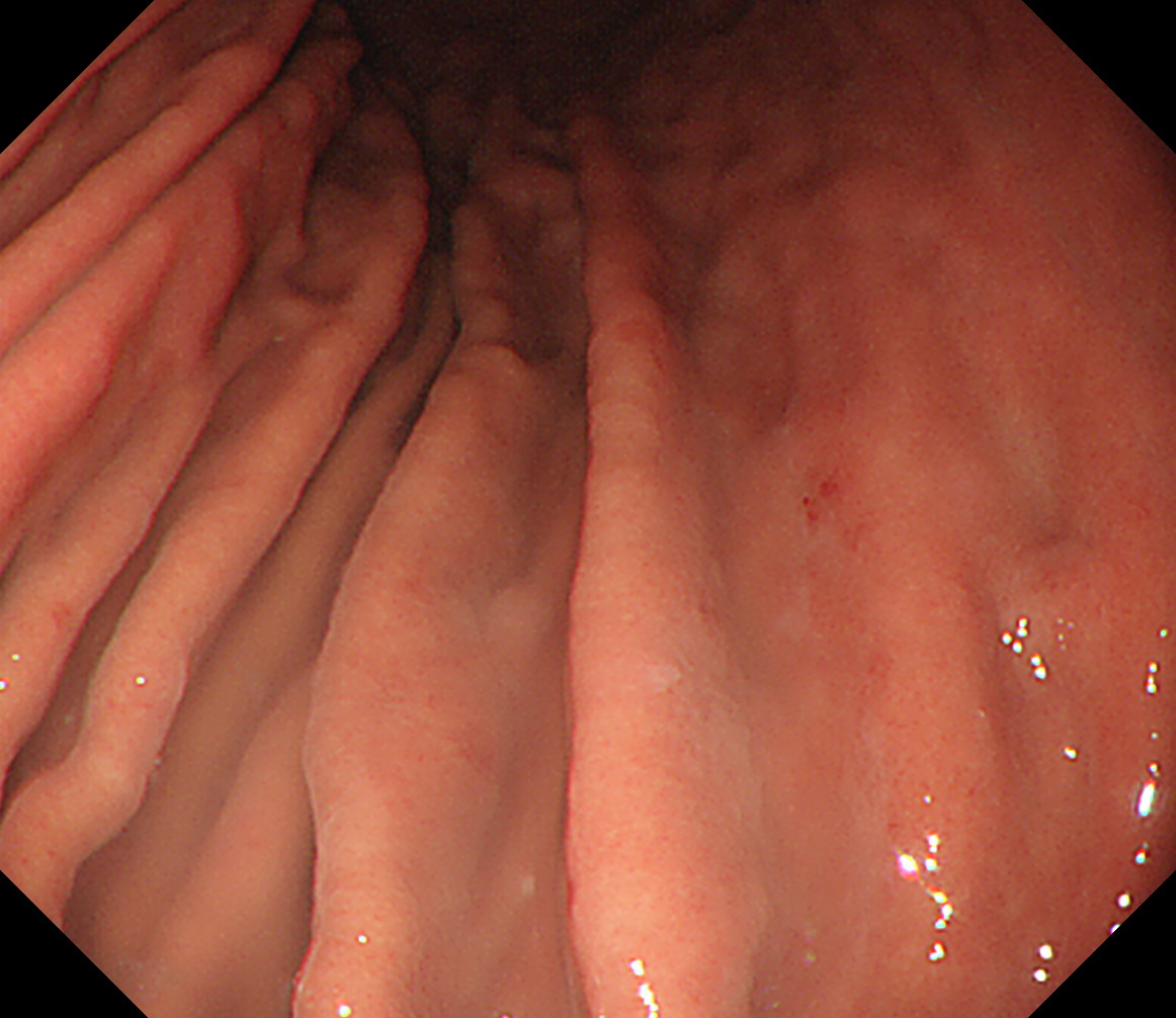 �̉����O��